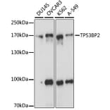 Western Blot - Anti-TP53BP2 Antibody (A15105) - Antibodies.com