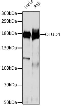 Western blot analysis of extracts of various cell lines, using Anti-OTUD4 Antibody (A15229) at 1:1,000 dilution.
Secondary antibody: Goat Anti-Rabbit IgG (H+L) (HRP) (AS014) at 1:10,000 dilution.
Lysates / proteins: 25µg per lane.
Blocking buffer: 3% non-fat dry milk in TBST.
Detection: ECL Basic Kit (RM00020).
Exposure time: 10s.