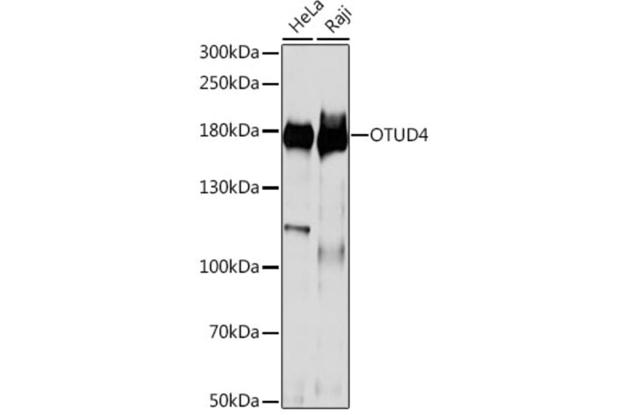 Western Blot - Anti-OTUD4/HIN-1 Antibody (A88488) - Antibodies.com