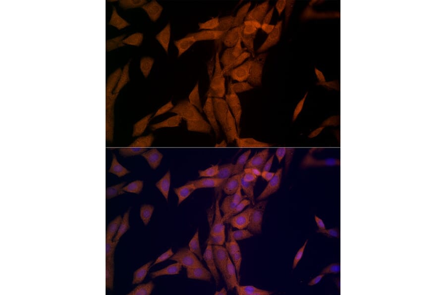 Immunofluorescence - Anti-OTUD4/HIN-1 Antibody (A88488) - Antibodies.com