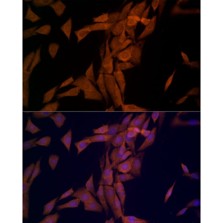 Immunofluorescence - Anti-OTUD4/HIN-1 Antibody (A88488) - Antibodies.com