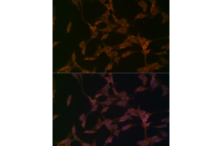 Immunofluorescence - Anti-OTUD4/HIN-1 Antibody (A88488) - Antibodies.com