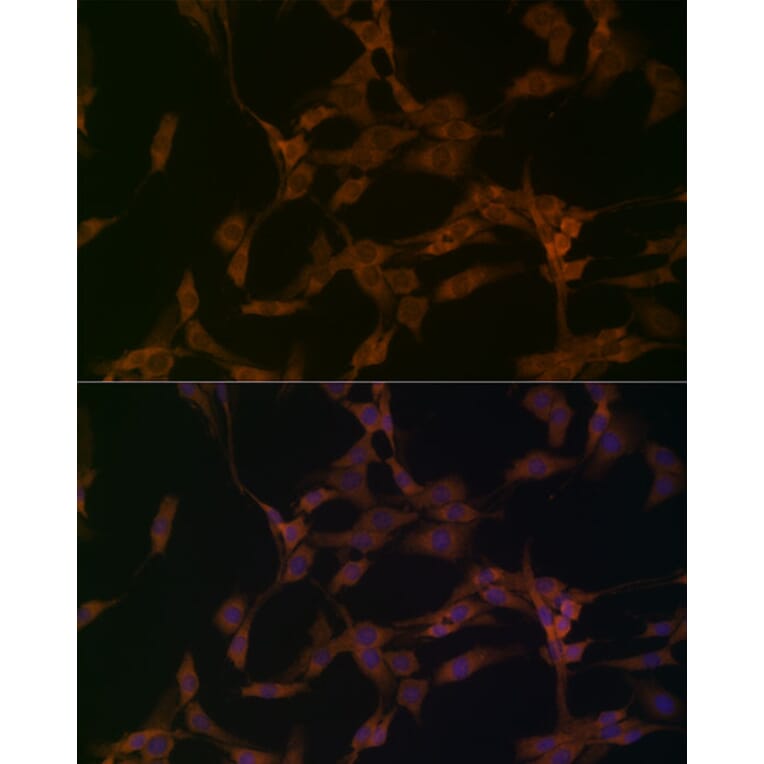 Immunofluorescence - Anti-OTUD4/HIN-1 Antibody (A88488) - Antibodies.com