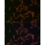 Immunofluorescence - Anti-OTUD4/HIN-1 Antibody (A88488) - Antibodies.com