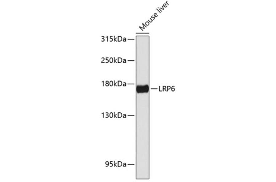 Western Blot - Anti-LRP6 Antibody (A88489) - Antibodies.com