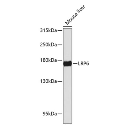 Western Blot - Anti-LRP6 Antibody (A88489) - Antibodies.com