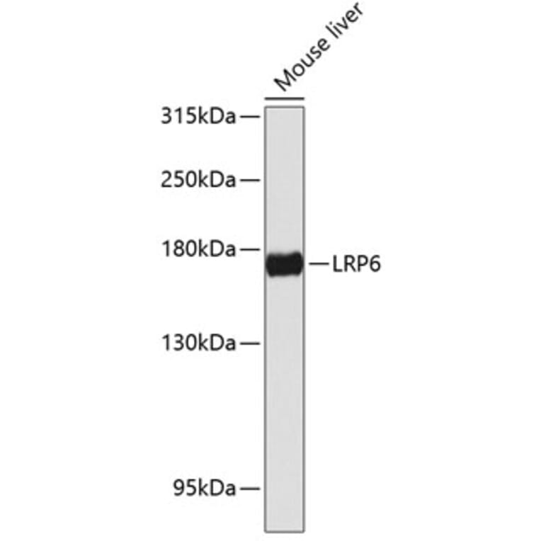 Western Blot - Anti-LRP6 Antibody (A88489) - Antibodies.com