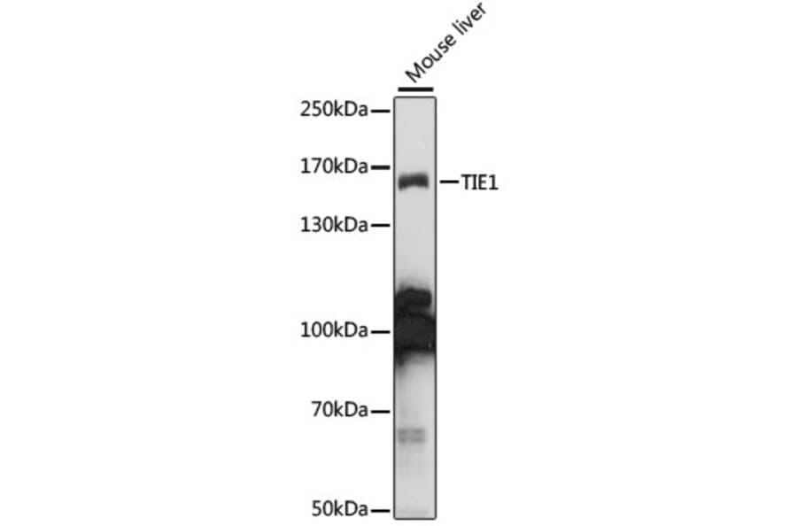 Western Blot - Anti-TIE1 Antibody (A15104) - Antibodies.com