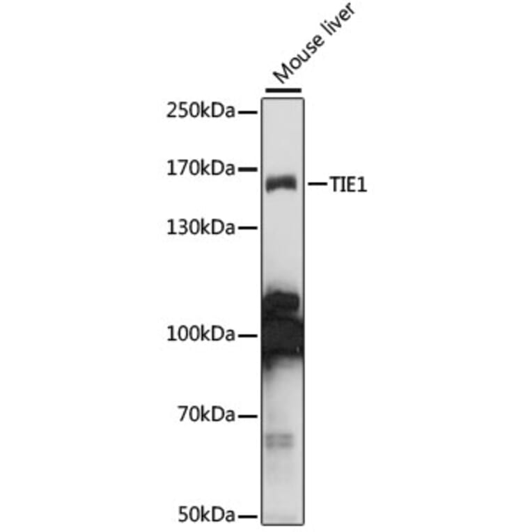 Western Blot - Anti-TIE1 Antibody (A15104) - Antibodies.com