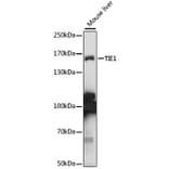 Western Blot - Anti-TIE1 Antibody (A15104) - Antibodies.com