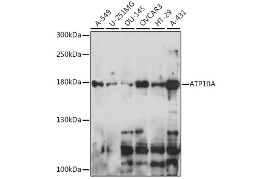 Western Blot - Anti-ATP10A Antibody (A88491) - Antibodies.com
