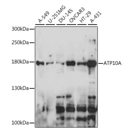 Western Blot - Anti-ATP10A Antibody (A88491) - Antibodies.com