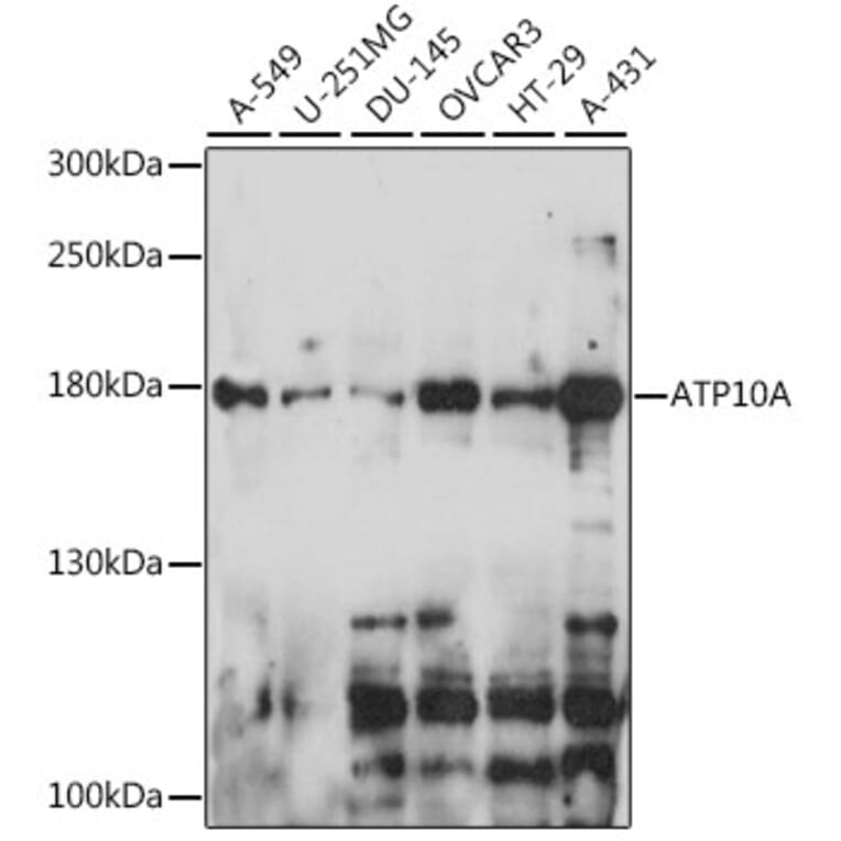 Western Blot - Anti-ATP10A Antibody (A88491) - Antibodies.com