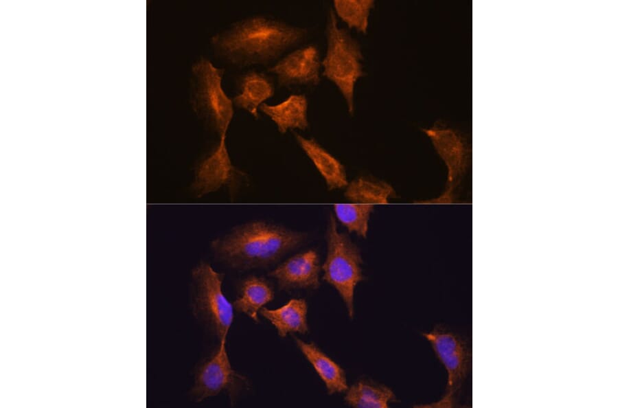 Immunofluorescence - Anti-HOOK3 Antibody (A88492) - Antibodies.com
