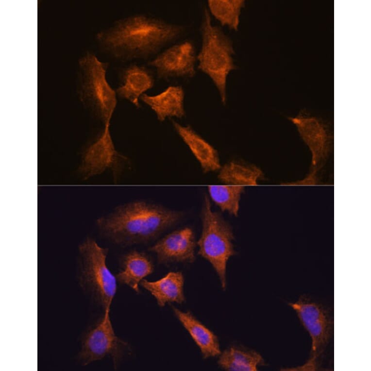 Immunofluorescence - Anti-HOOK3 Antibody (A88492) - Antibodies.com