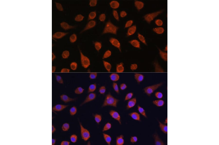 Immunofluorescence - Anti-HOOK3 Antibody (A88492) - Antibodies.com