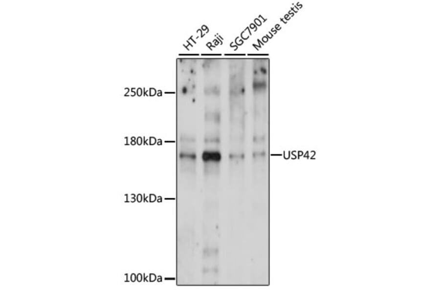 Western Blot - Anti-USP42 Antibody (A88493) - Antibodies.com