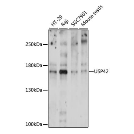 Western Blot - Anti-USP42 Antibody (A88493) - Antibodies.com