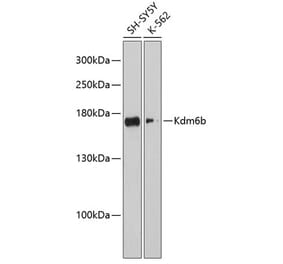 Western Blot - Anti-KDM6B / JMJD3 Antibody (A88494) - Antibodies.com