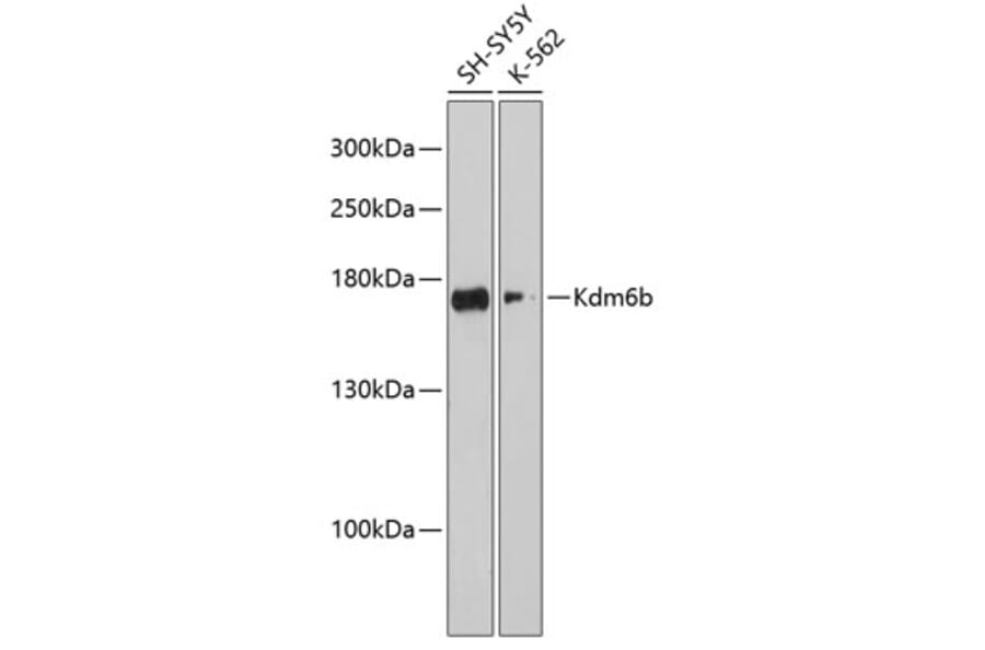 Western Blot - Anti-KDM6B/JMJD3 Antibody (A88494) - Antibodies.com