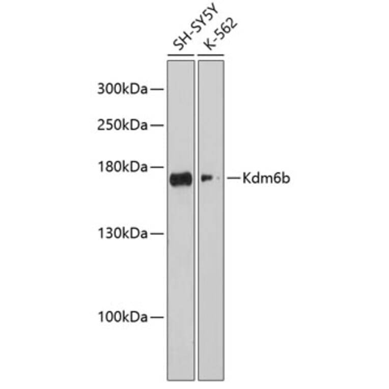 Western Blot - Anti-KDM6B/JMJD3 Antibody (A88494) - Antibodies.com