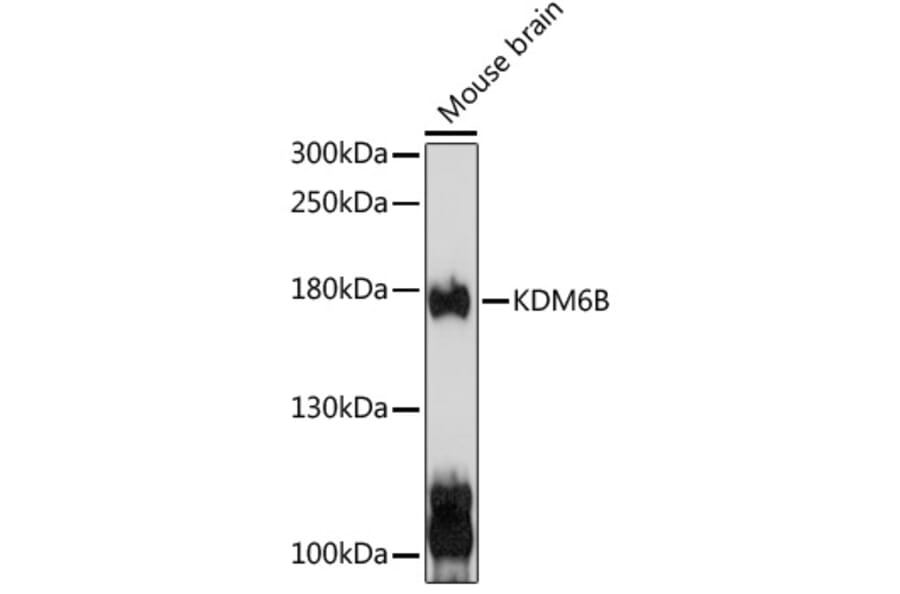 Western Blot - Anti-KDM6B/JMJD3 Antibody (A88494) - Antibodies.com