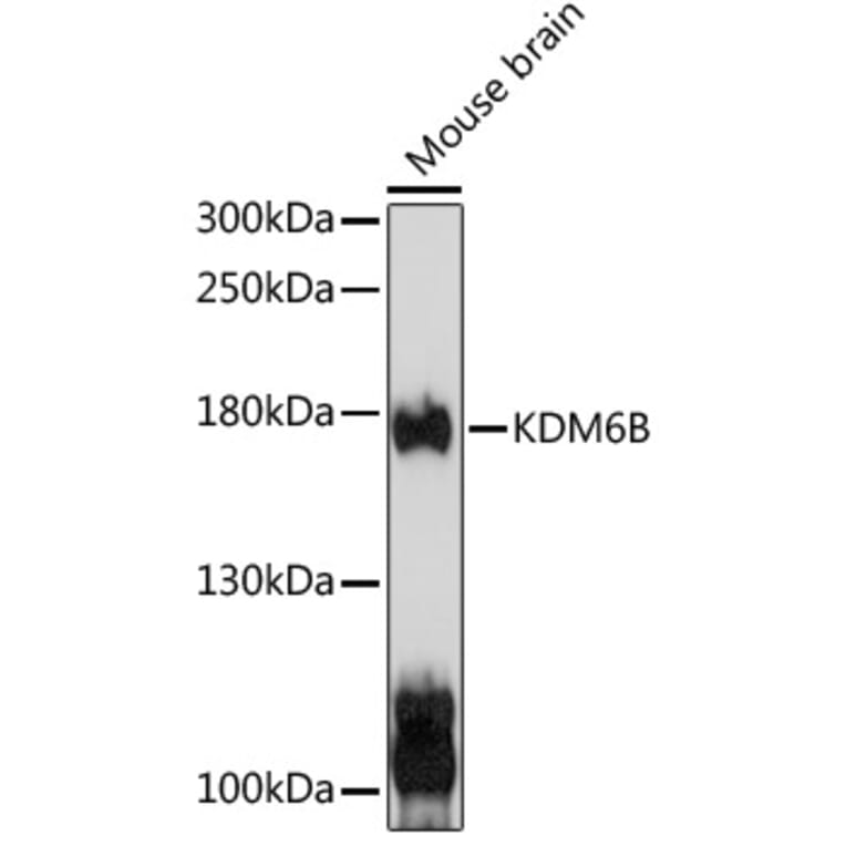 Western Blot - Anti-KDM6B/JMJD3 Antibody (A88494) - Antibodies.com