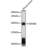 Western Blot - Anti-KDM6B/JMJD3 Antibody (A88494) - Antibodies.com