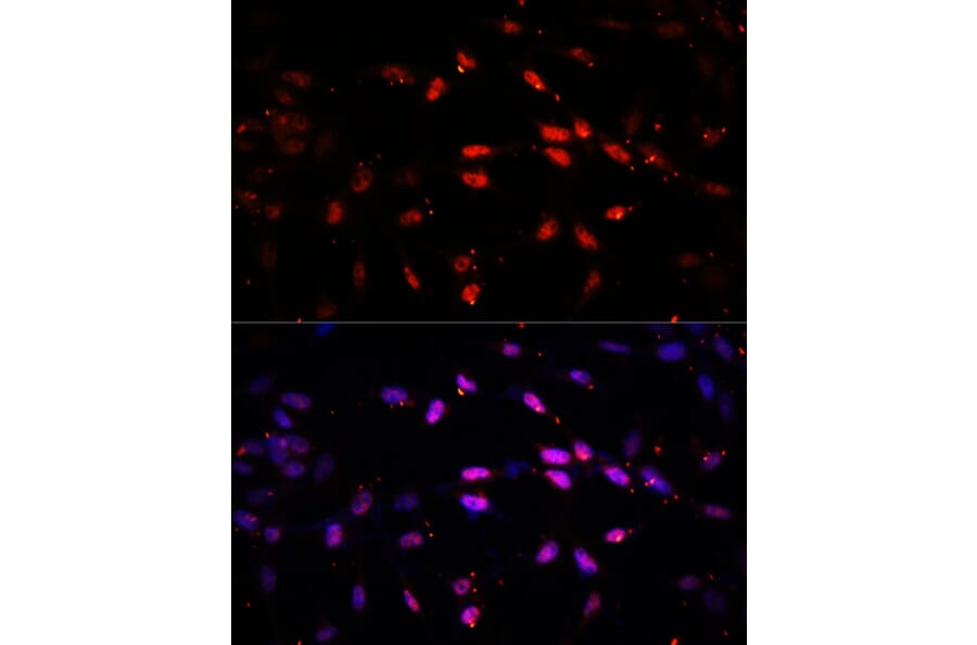 Immunofluorescence - Anti-KDM6B/JMJD3 Antibody (A88494) - Antibodies.com