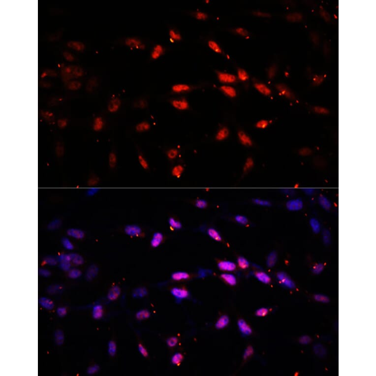 Immunofluorescence - Anti-KDM6B/JMJD3 Antibody (A88494) - Antibodies.com