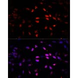 Immunofluorescence - Anti-KDM6B/JMJD3 Antibody (A88494) - Antibodies.com