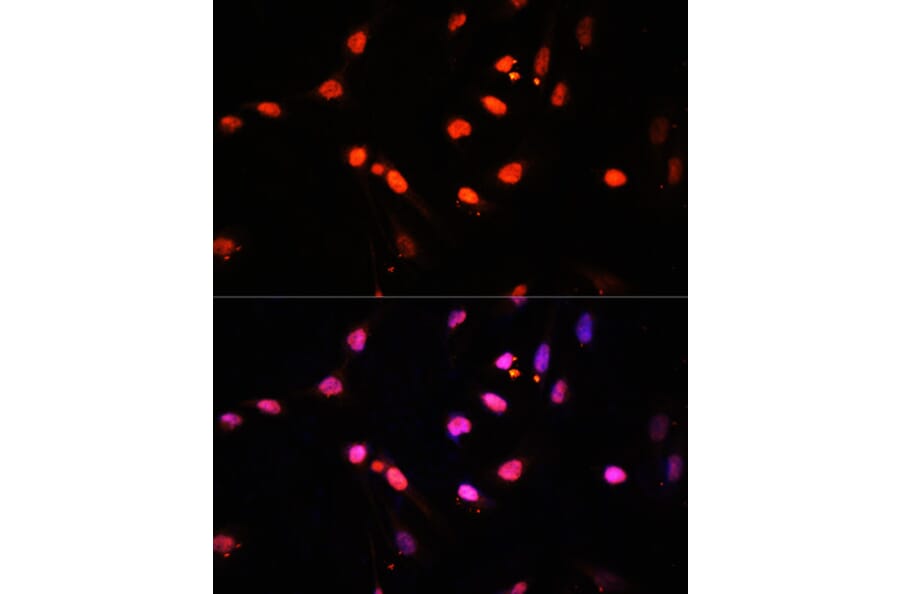 Immunofluorescence - Anti-KDM6B/JMJD3 Antibody (A88494) - Antibodies.com