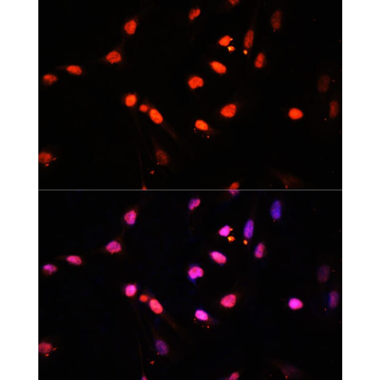 Immunofluorescence - Anti-KDM6B/JMJD3 Antibody (A88494) - Antibodies.com