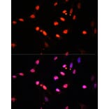 Immunofluorescence - Anti-KDM6B/JMJD3 Antibody (A88494) - Antibodies.com
