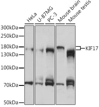 Western blot analysis of extracts of various cell lines, using Anti-KIF17 Antibody (A16562) at 1:1,000 dilution.
Secondary antibody: Goat Anti-Rabbit IgG (H+L) (HRP) (AS014) at 1:10,000 dilution.
Lysates / proteins: 25µg per lane.
Blocking buffer: 3% non-fat dry milk in TBST.
Detection: ECL Basic Kit (RM00020).
Exposure time: 30s.