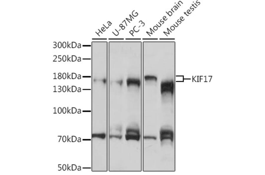 Western Blot - Anti-KIF17 Antibody (A88495) - Antibodies.com