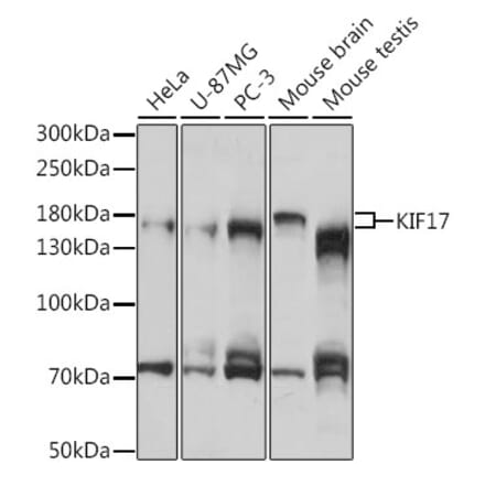 Western Blot - Anti-KIF17 Antibody (A88495) - Antibodies.com