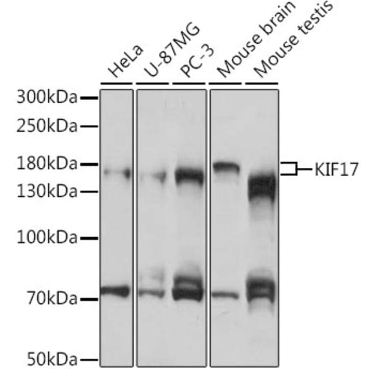 Western Blot - Anti-KIF17 Antibody (A88495) - Antibodies.com