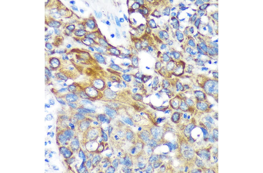 Immunohistochemistry - Anti-KIF17 Antibody (A88495) - Antibodies.com