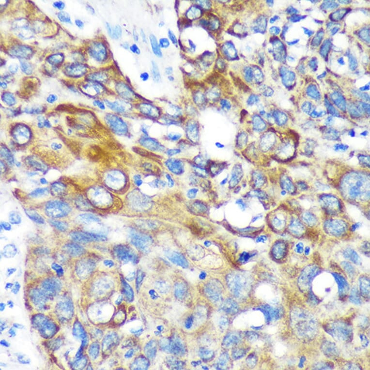 Immunohistochemistry - Anti-KIF17 Antibody (A88495) - Antibodies.com