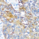 Immunohistochemistry - Anti-KIF17 Antibody (A88495) - Antibodies.com