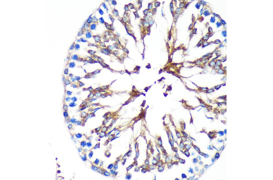 Immunohistochemistry - Anti-KIF17 Antibody (A88495) - Antibodies.com