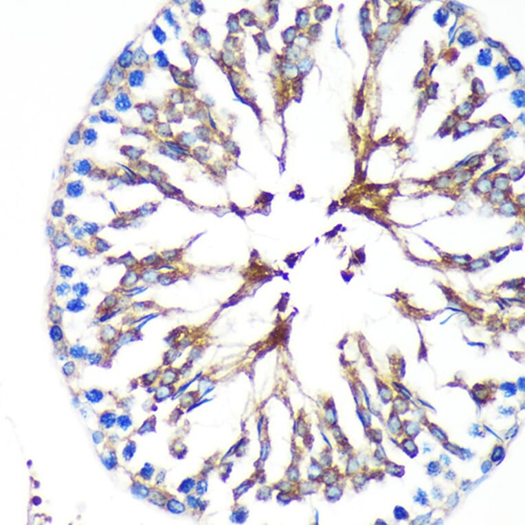 Immunohistochemistry - Anti-KIF17 Antibody (A88495) - Antibodies.com