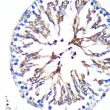 Immunohistochemistry - Anti-KIF17 Antibody (A88495) - Antibodies.com