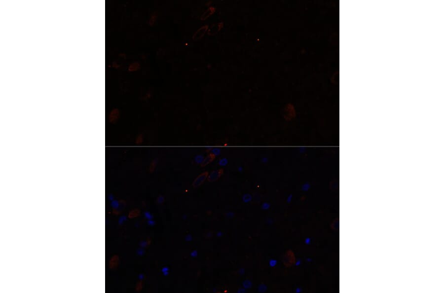 Immunofluorescence - Anti-KIF17 Antibody (A88495) - Antibodies.com