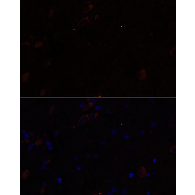 Immunofluorescence - Anti-KIF17 Antibody (A88495) - Antibodies.com