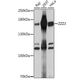 Western Blot - Anti-ZZZ3 Antibody (A88496) - Antibodies.com