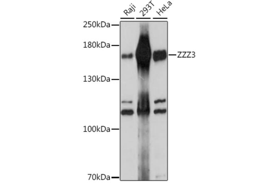 Western Blot - Anti-ZZZ3 Antibody (A88496) - Antibodies.com