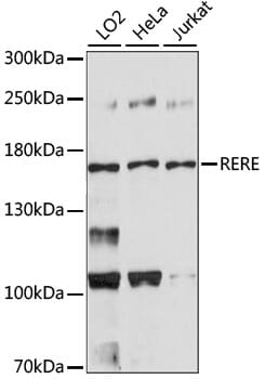 Western blot analysis of extracts of various cell lines, using Anti-RERE Antibody (A15255).
Secondary antibody: Goat Anti-Rabbit IgG (H+L) (HRP) (AS014) at 1:10,000 dilution.
Lysates / proteins: 25µg per lane.
Blocking buffer: 3% non-fat dry milk in TBST.
Detection: ECL Basic Kit (RM00020).
Exposure time: 90s.