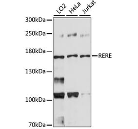 Western Blot - Anti-RERE Antibody (A88498) - Antibodies.com